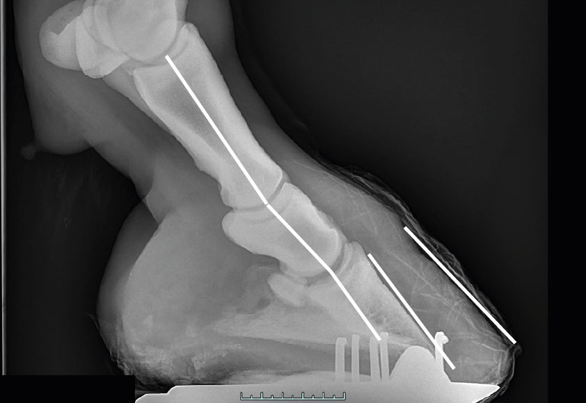 Röntgenbild eines Hufes mit nach hinten gebrochener Huf-Fessel-Achse, einer kleinen Streckung im Krongelenk, einer kleinen Beugung im Hufgelenk und einem etwas verbreiterten Hufbeinträger