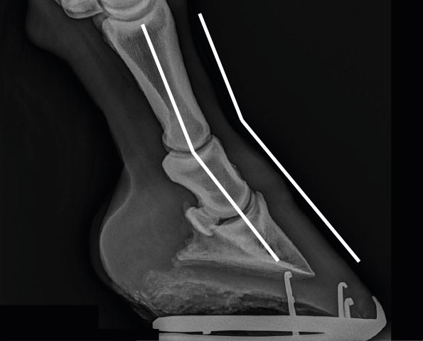 Röntgenbild eines Hufes mit nach hinten gebrochener Huf-Fessel-Achse und einer Überstreckung des Krongelenkes
