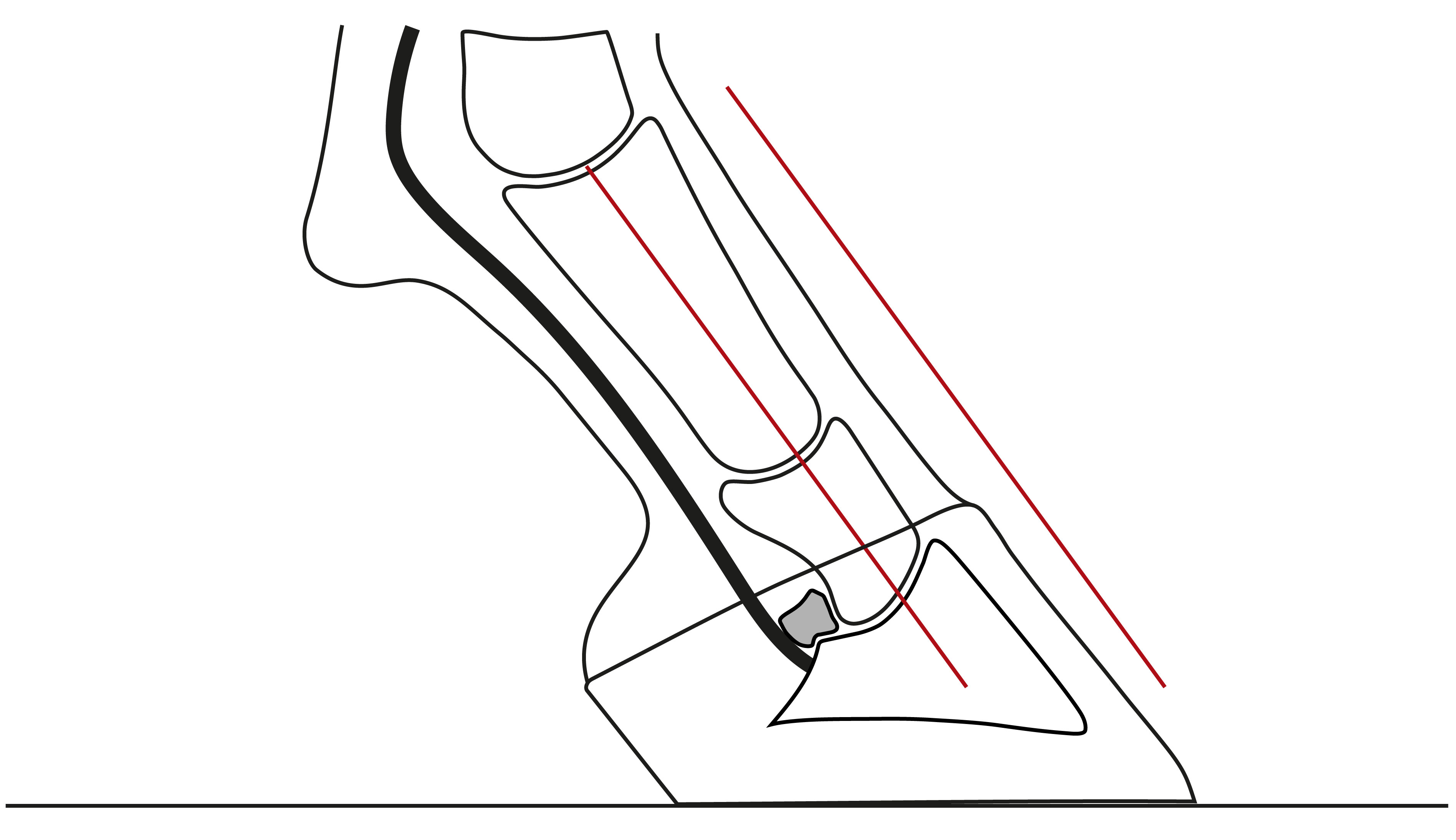 Illustration einer ungebrochenen Huf-Fessel-Achse