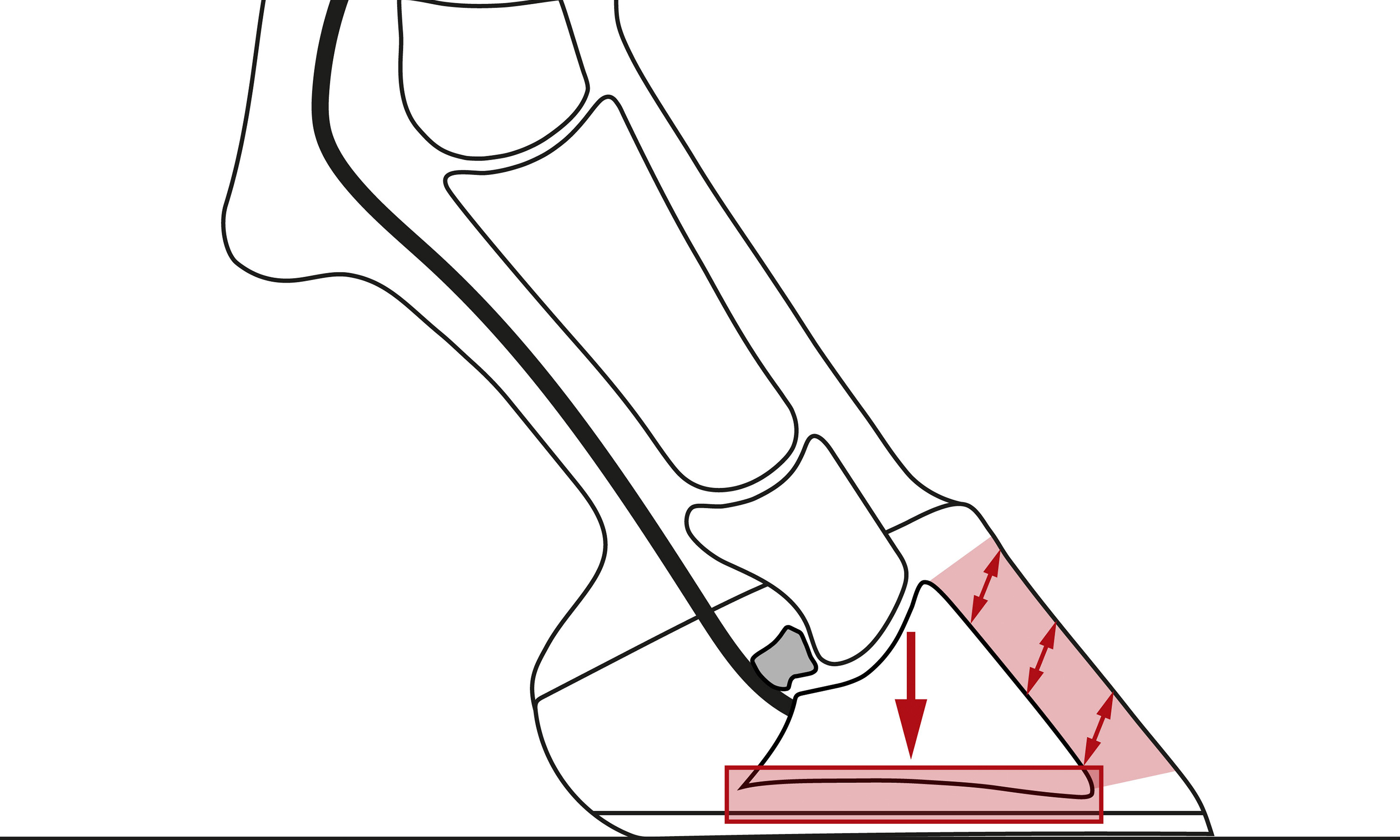 Illustration einer Hufbeinabsenkung bei einer akuten Hufrehe