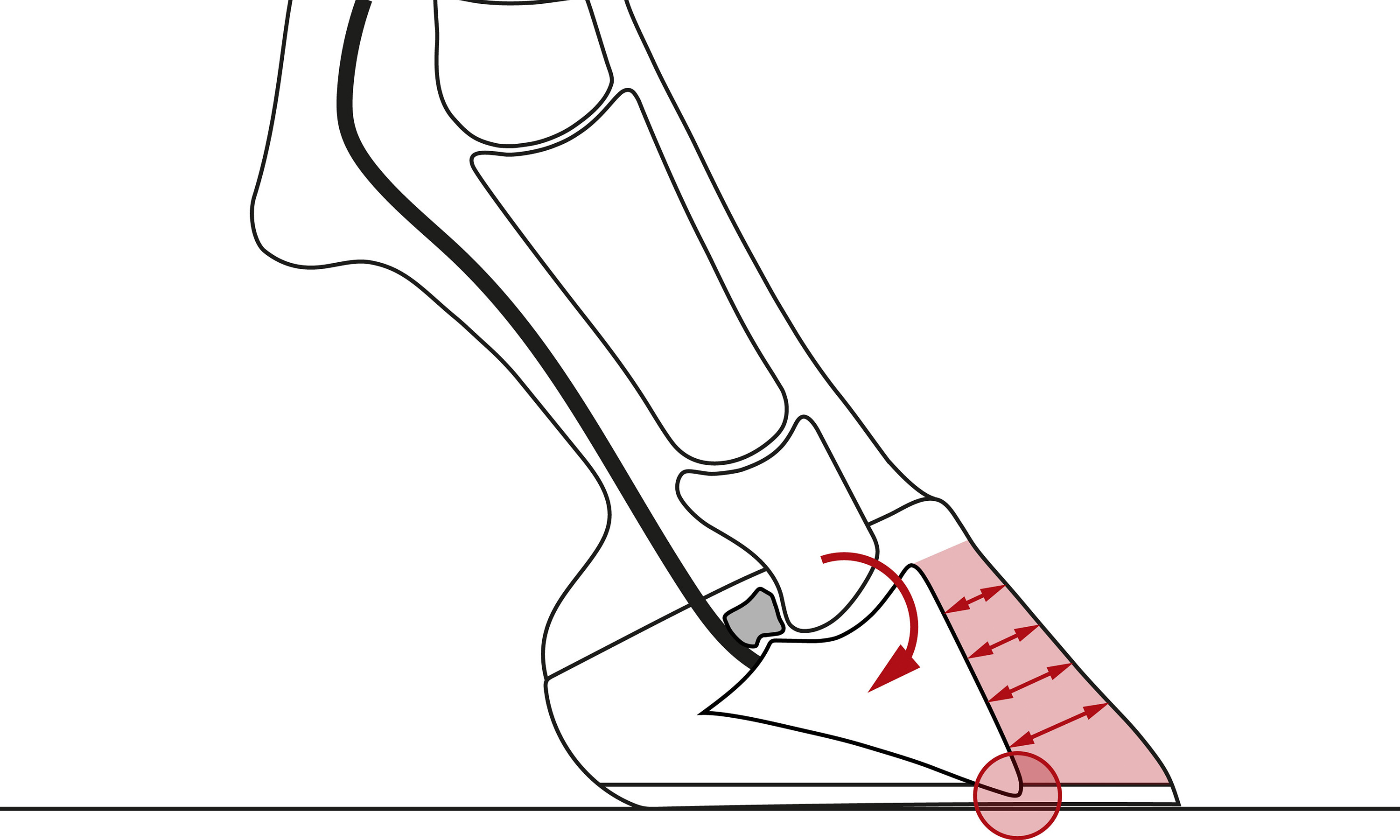 Illustration einer Hufbeinrotation bei einer chronischen Hufrehe