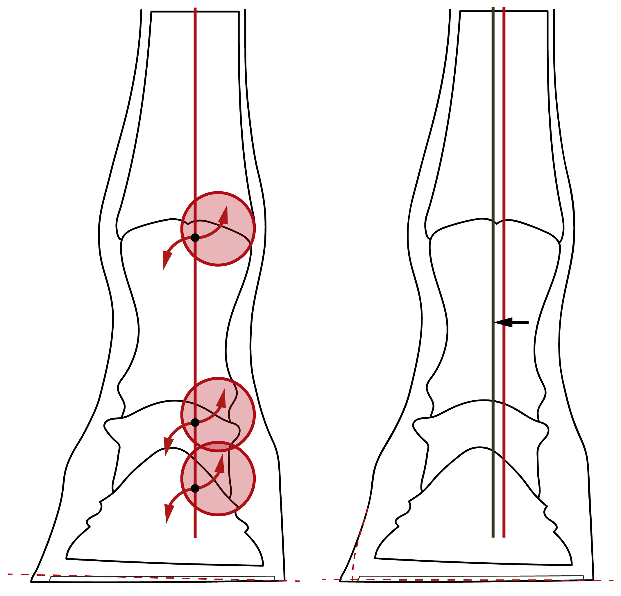 Illustration zum Vergleich des üblichen Bearbeitungsansatzes eines einseitigen Hufes mit dem huforthopädischen Ansatz