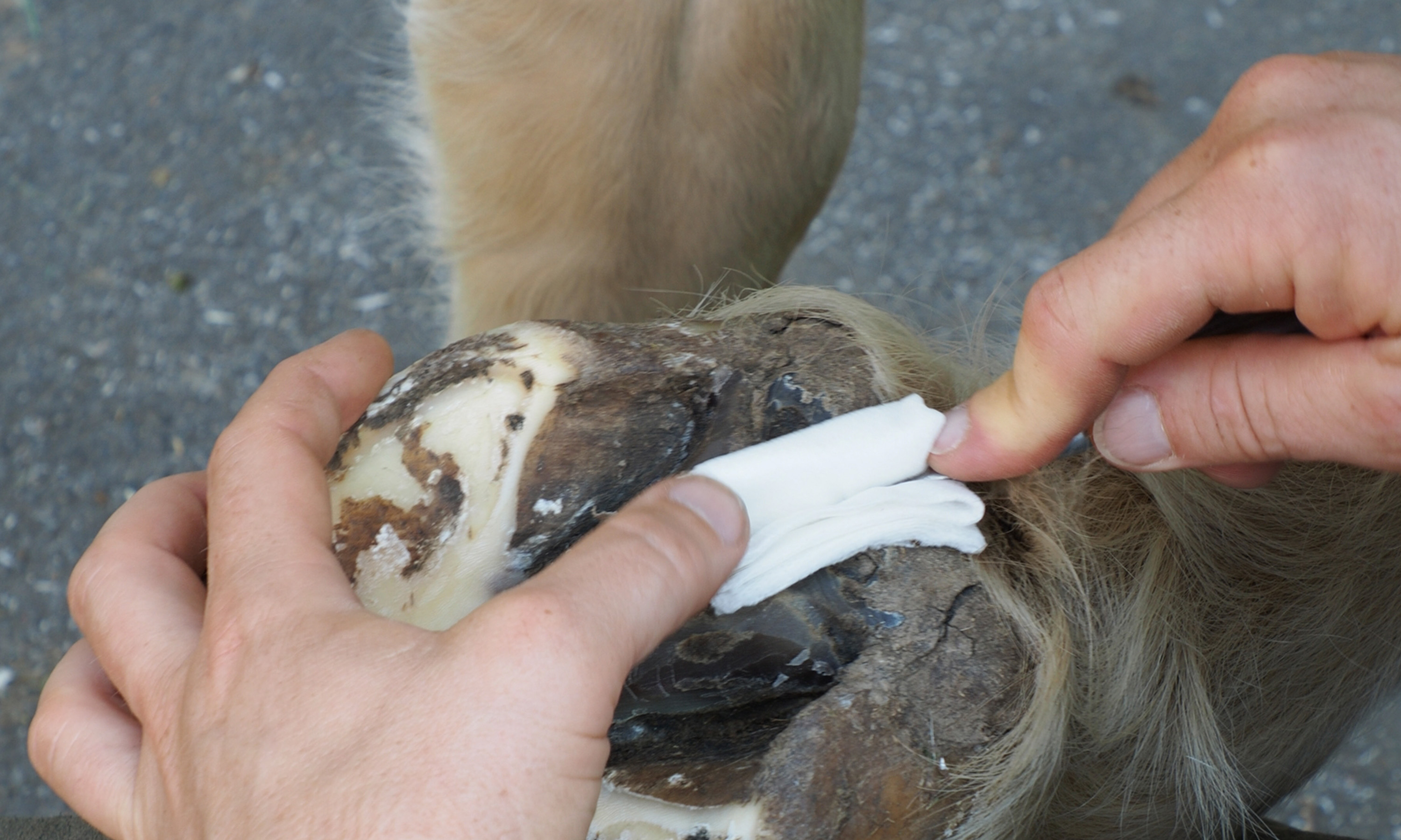 Stopfen der mittleren Strahlfurche mit Watte zur Behandlung von Strahlfäulnis