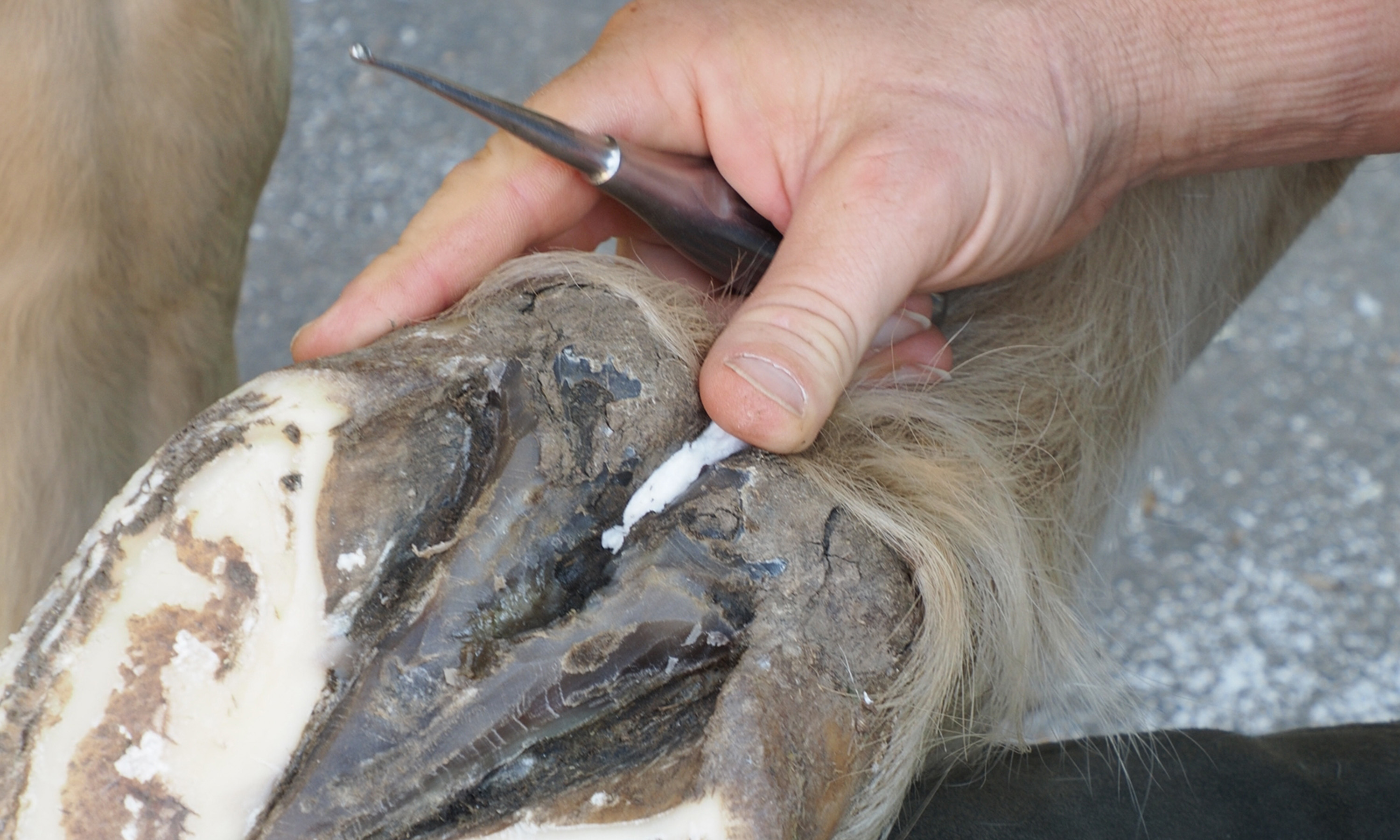 Stopfen der mittleren Strahlfurche mit Watte zur Behandlung von Strahlfäulnis